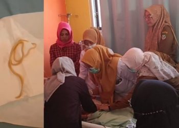 Dirujuk, Balita 1,8 Tahun Asal Seluma yang Keluarkan Cacing Kini Jalani Perawatan di RSUD M. Yunus
