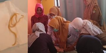 Dirujuk, Balita 1,8 Tahun Asal Seluma yang Keluarkan Cacing Kini Jalani Perawatan di RSUD M. Yunus