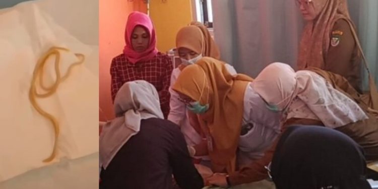 Dirujuk, Balita 1,8 Tahun Asal Seluma yang Keluarkan Cacing Kini Jalani Perawatan di RSUD M. Yunus