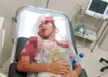 Geng Motor Beraksi Dini Hari, 2 Pemuda Bengkulu Jadi Korban Pembacokan dan Pemukulan