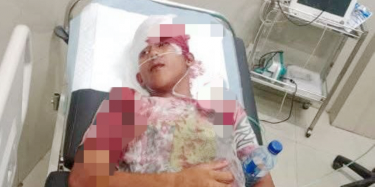 Geng Motor Beraksi Dini Hari, 2 Pemuda Bengkulu Jadi Korban Pembacokan dan Pemukulan