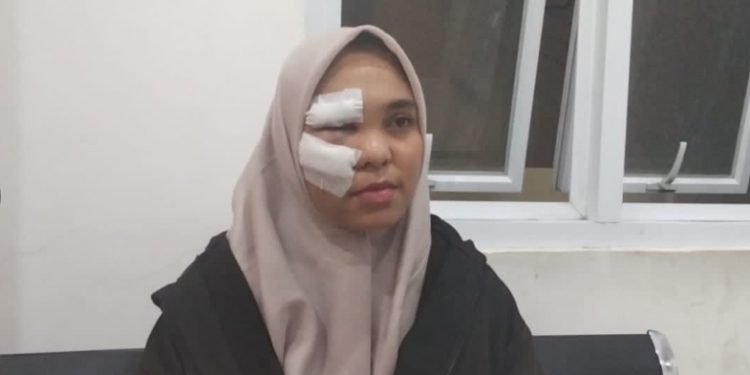 Kasus Tabrak Lari Fortuner di Simpang Kapuas, Polisi Buka Ruang Laporan dari Korban