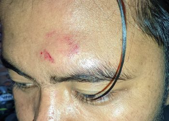 2 Korban Diserang Gerombolan Pemuda Bersajam di Danau Dendam Tak Sudah, Begini Kronologinya