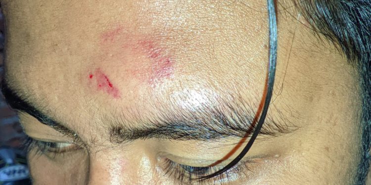 2 Korban Diserang Gerombolan Pemuda Bersajam di Danau Dendam Tak Sudah, Begini Kronologinya